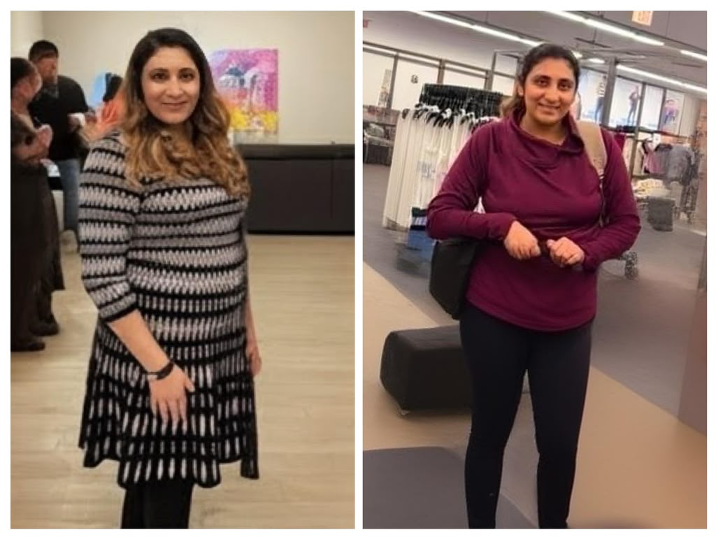 Before and after photo of a female participant